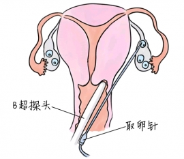 幼儿学画画，苏州捐卵宝宝学画画，学画画的好处，如何学画画